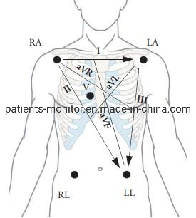 Goldway GS10 Patient Monitor Cable ECG 5 Lead Set 074260312A