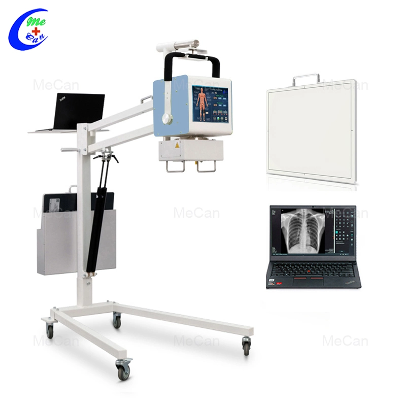 Radiography Chest Machine Other Radiology Equipment Radiographe Ray X Portable with Cheap Price