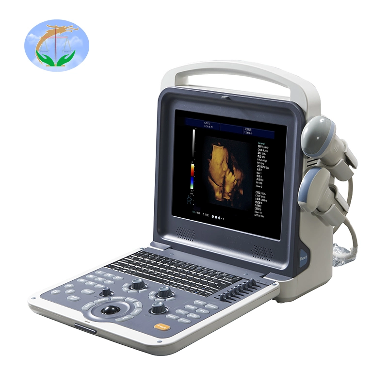 Medical Equipment Portable 4D Color Doppler Ultrasound Diagnosis System for Ob Gyn