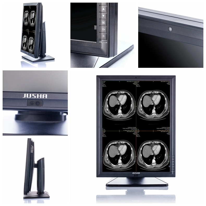 (JUSHA-M23C) 2MP 1600X1200 do Monitor de LED de diagnóstico por raios X e equipamentos médicos de marcação