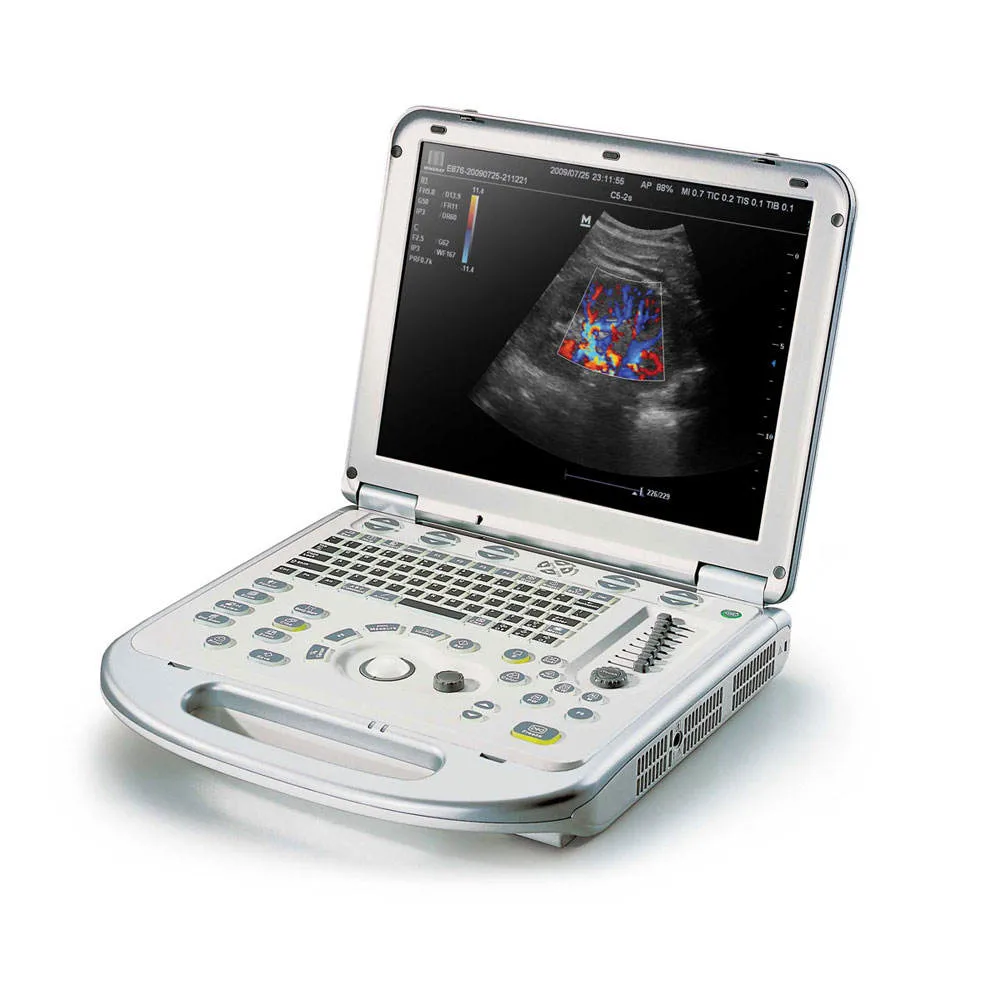 Mindray M7 Laptop Color Doppler Ultrasound