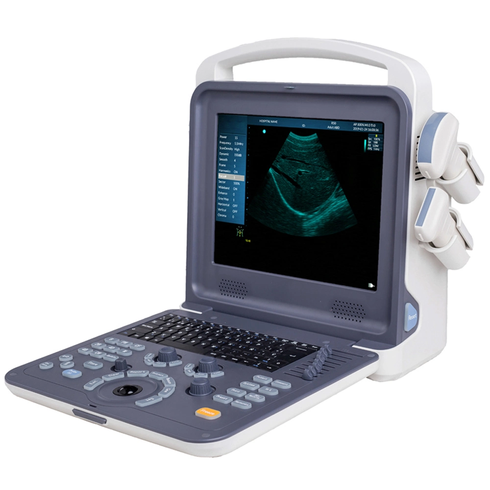 Fábrica Precio Mayorista/Proveedor completo Digital portátil Doppler Color Diagnóstico por ultrasonido Sistema