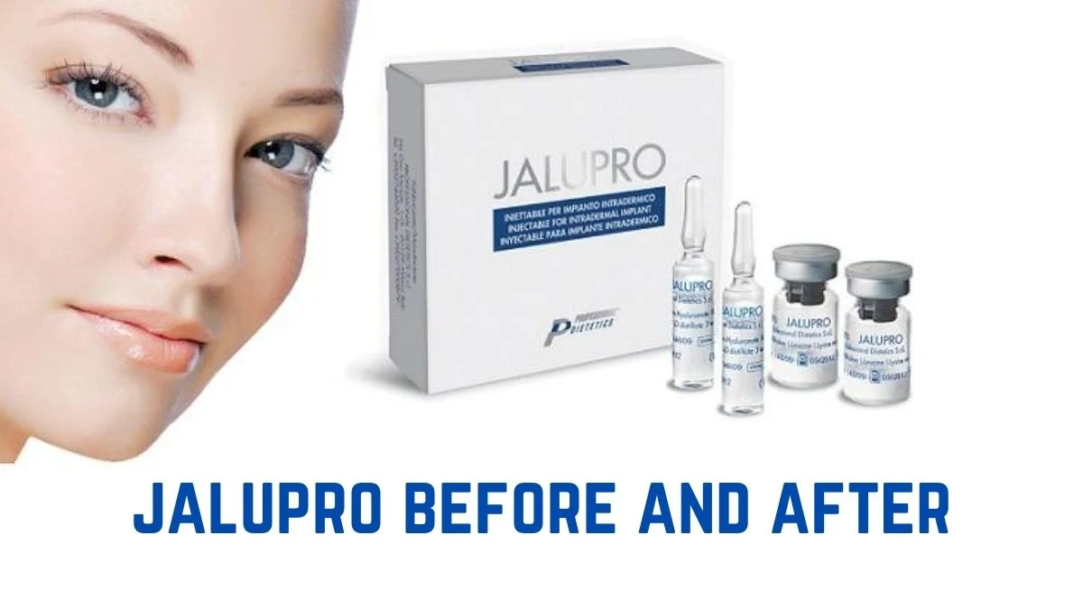 2023 Skin Booster Jalupro Hmw Super Hydro Amino Acid Jalupro Skin Booster Mesotherapy Dark Circles Treatment Mesotherapy Injection Biorevitalizer Anti-Aging