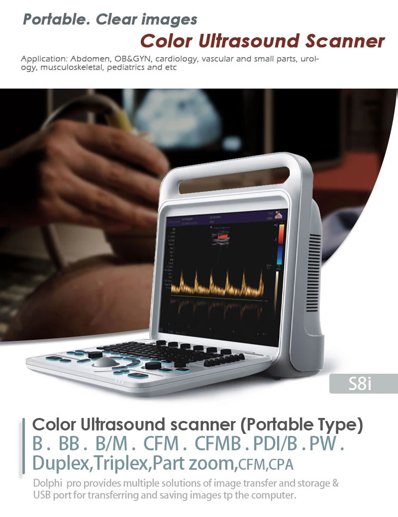 S8I ecógrafo portátil portátil CE e ISO aprobadas a partir de Meditech