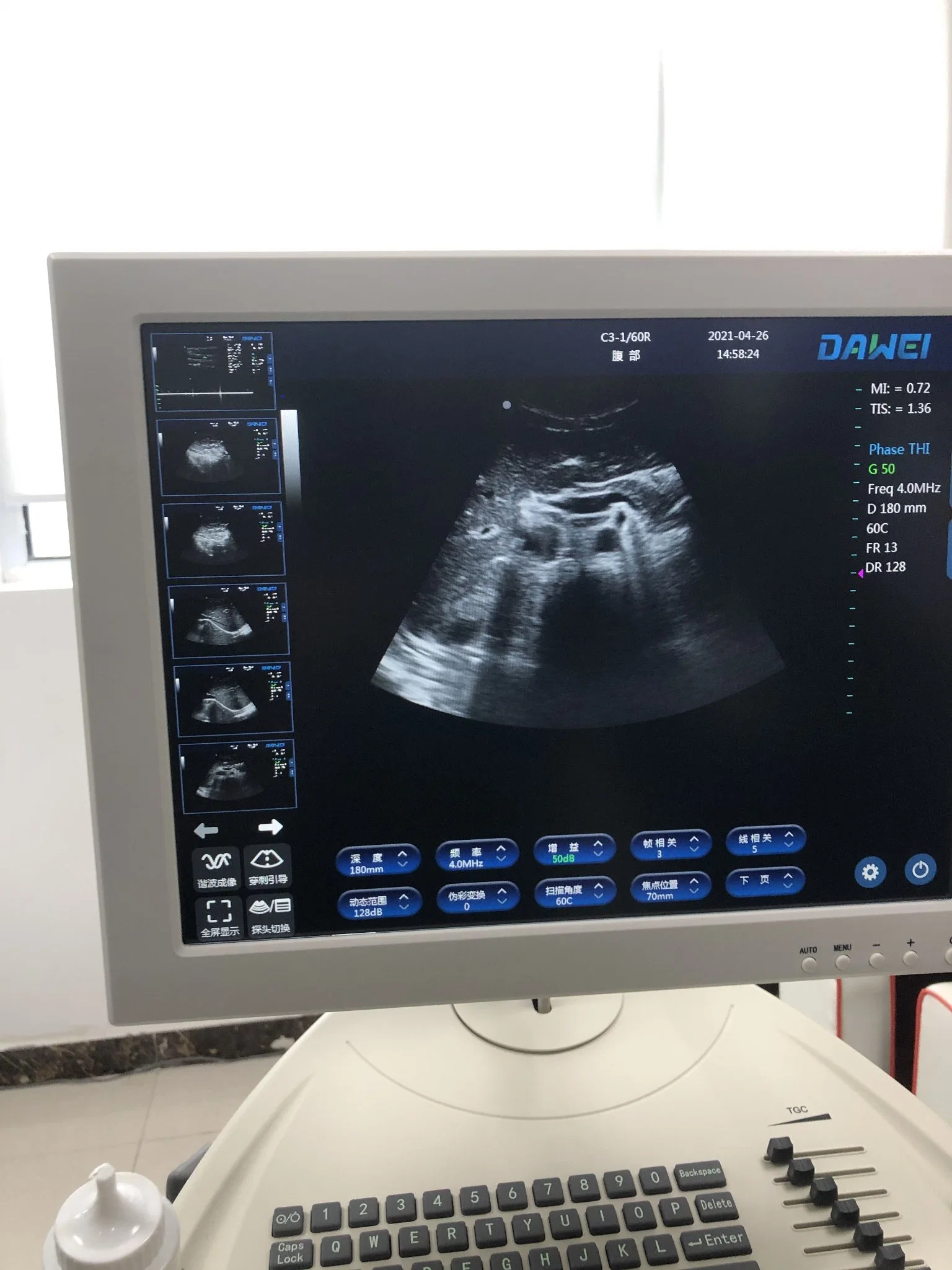 Cost-Effective Black and White Ultrasound Dw-370PC