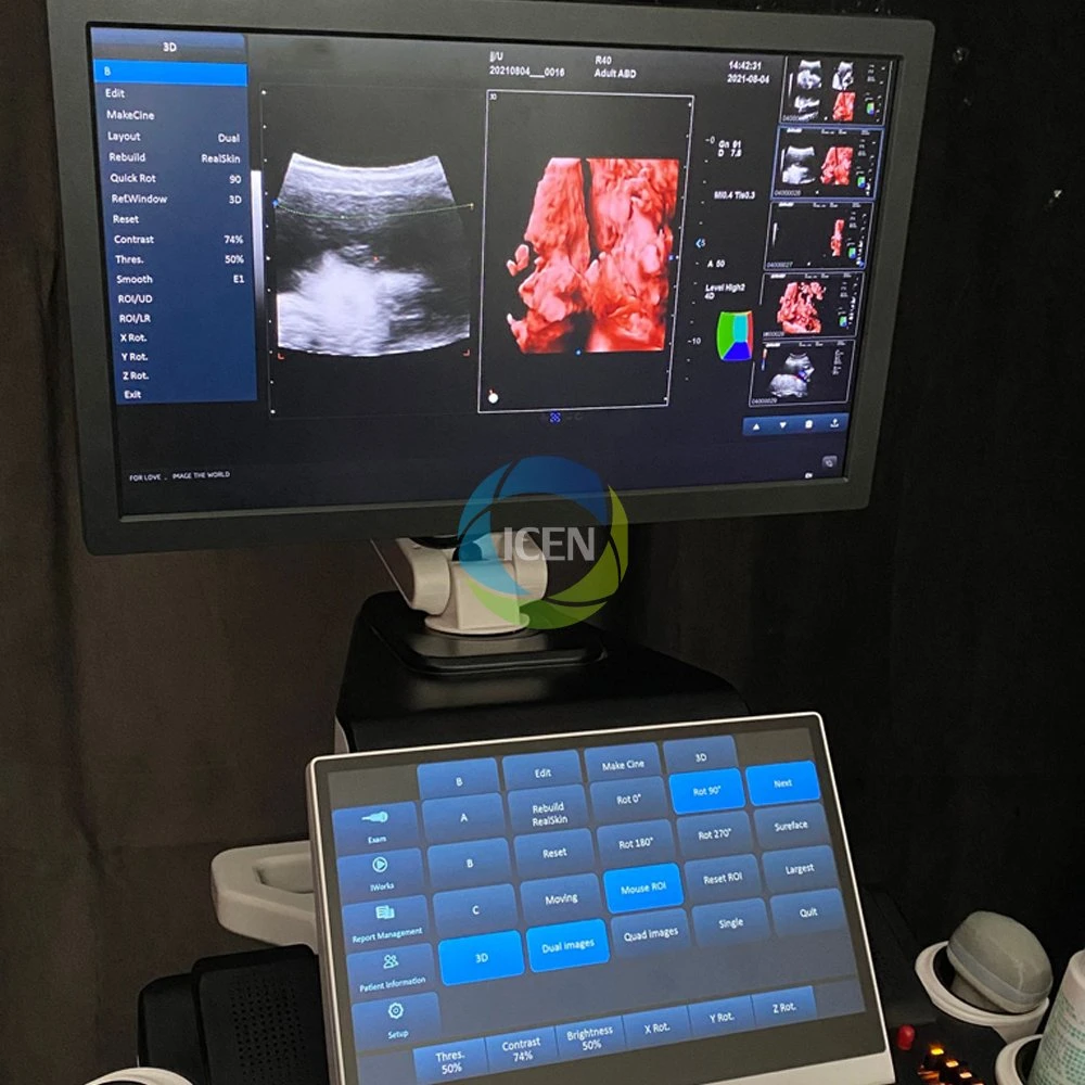 In-AT5 PRO digital 3D 4D 5D color Doppler b رخيص الأبعاد ماسح طبي بالموجات فوق الصوتية