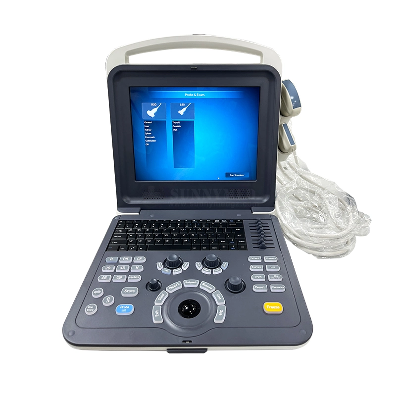 Sy-A042-1 Medical Diagnostic Equipment Cheapest 2D Portable Color Doppler Ultrasound Scanner