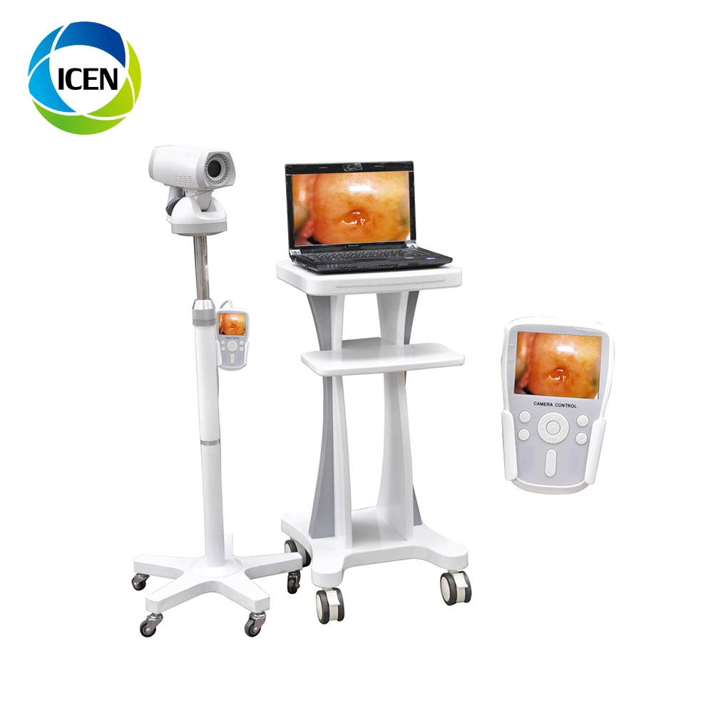 In-G9800A Medical Equipment Colposcope Digital Imaging System Specifications White LED (مواصفات نظام التصوير الرقمي في G9800A) مصدر الضوء لمنظار كولبوسكوب