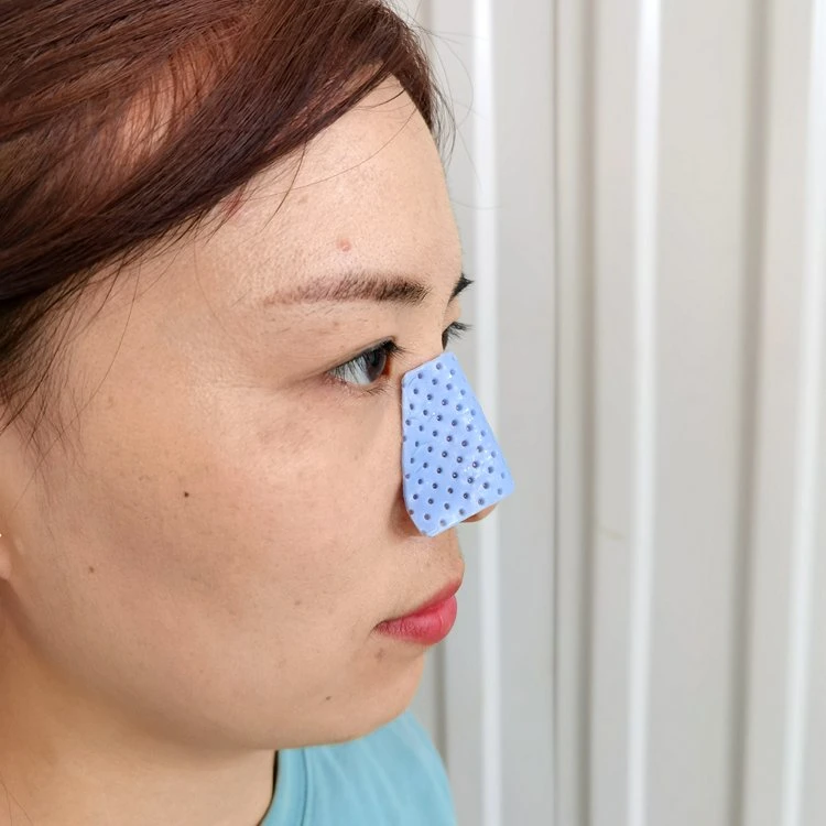 Direct Source Blue Color Nose Splint for Plastic Surgery Rhinoplasty