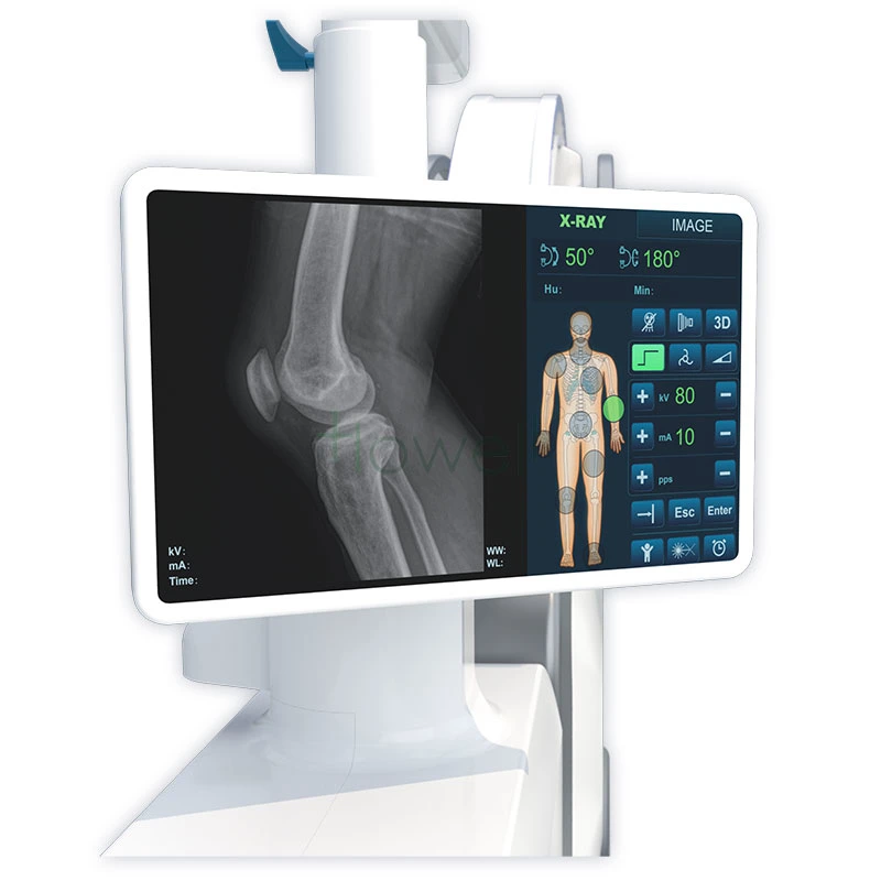 Mobile Digital C-Arm System Digital Radiography System Equipment Raidography X-ray Imaging System