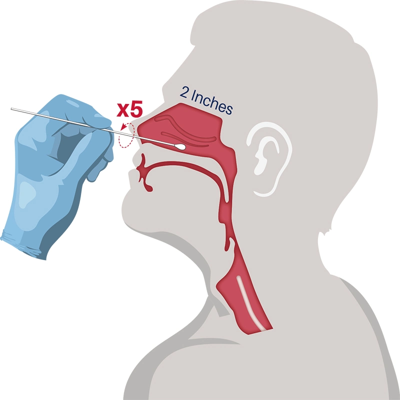 Du nasopharynx écouvillons nasaux floqué écouvillon coton-tige d'essai d'acide nucléique