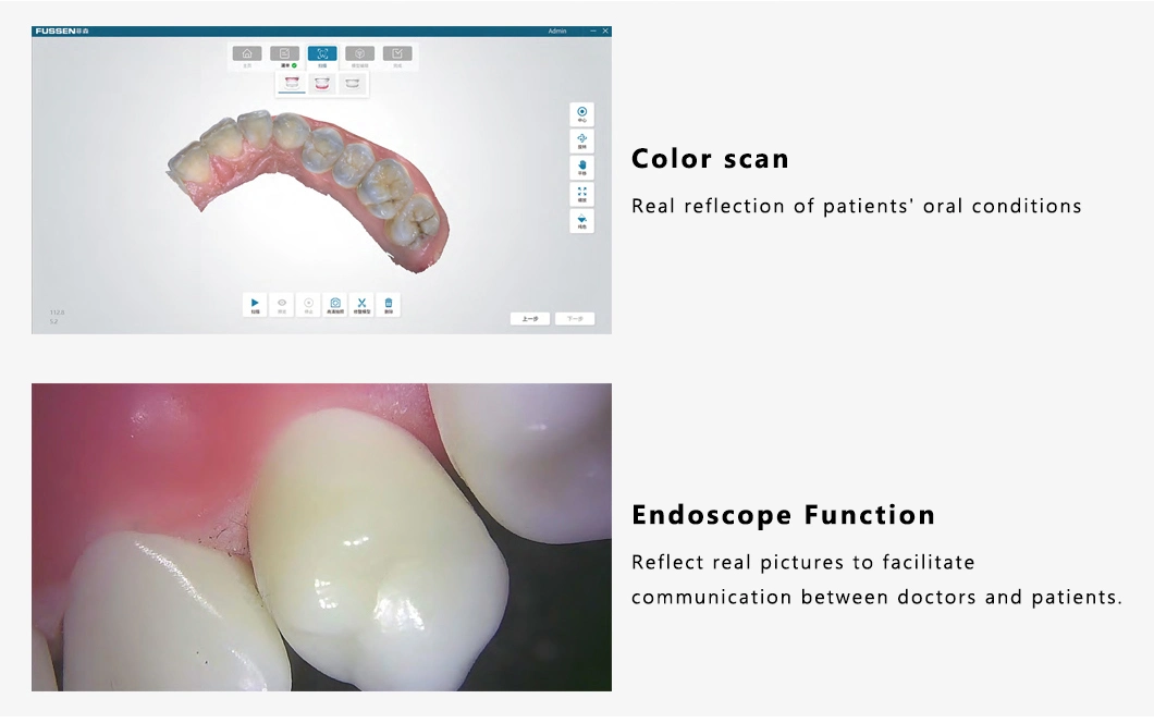 Интраоральный сканер Dental для стоматологических клиник