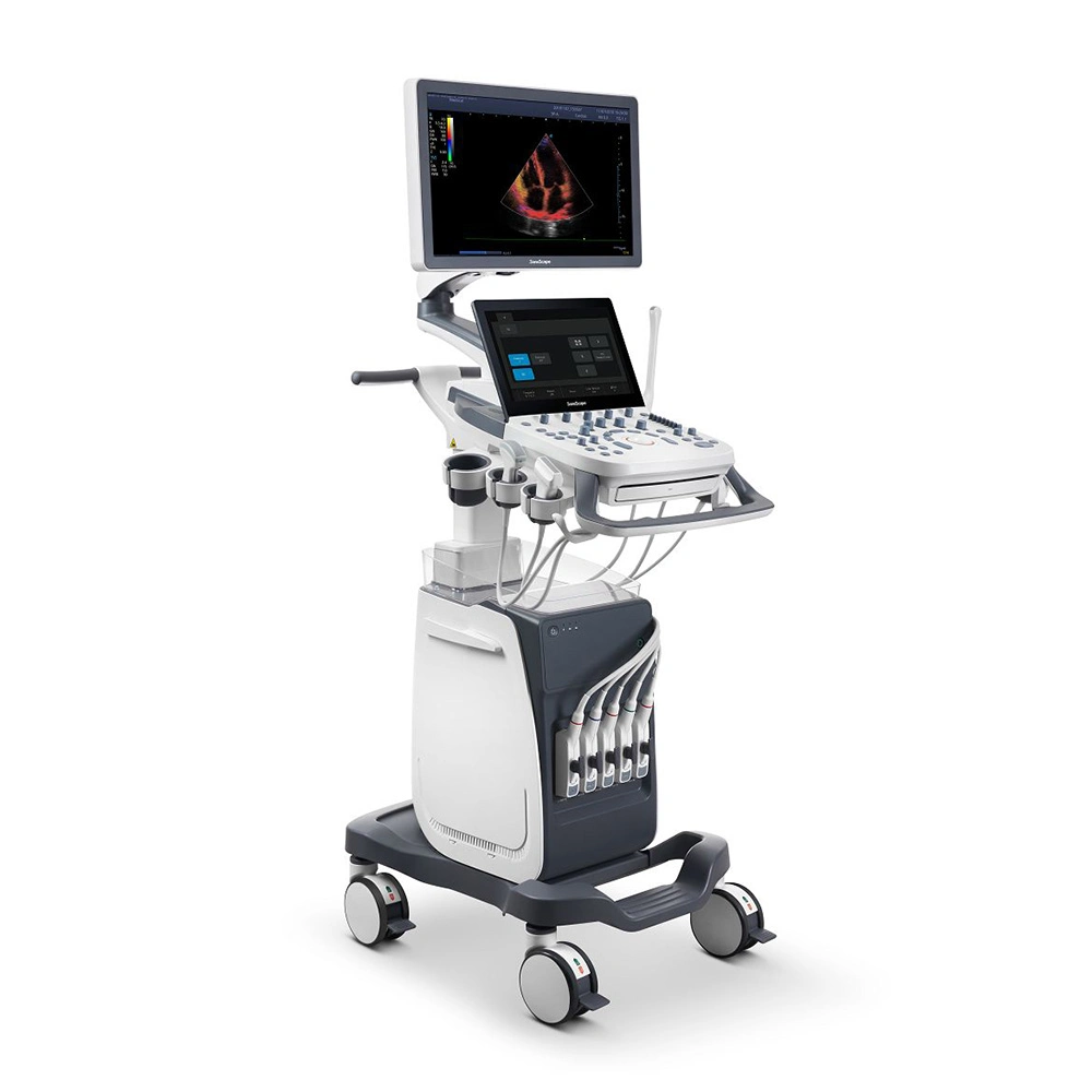 P9 Elite Trolley Ultrasound with Large Capacity Battery Color Doppler Ultrasound System 3D 4D Sonoscape P9 Ultrasound