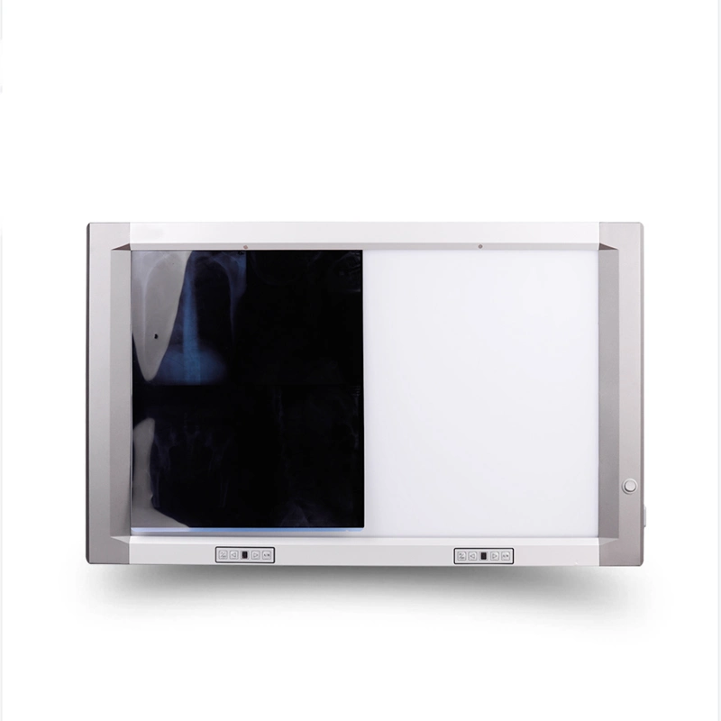 Super Thin Portable Double Panel X Ray LED Medical Film Viewer