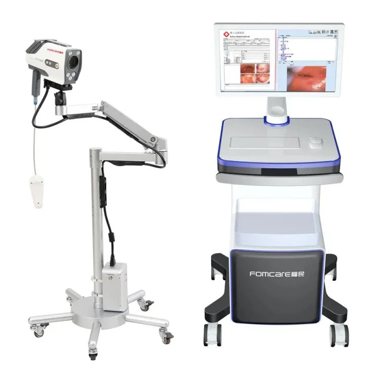 2023 Hot Sale Portable Digital Video Colposcopio Colposcope Systems for Vagina