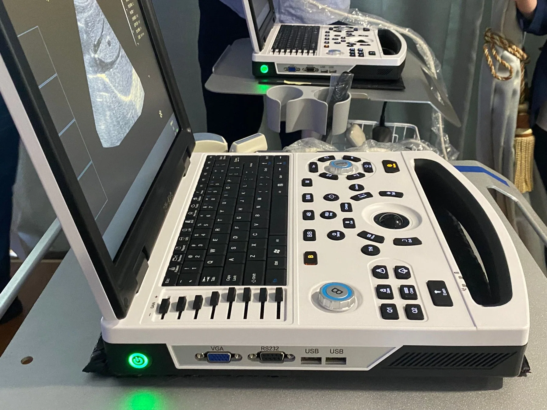 Cutting-Edge Smart Laptop Echo Medical Device for Hospital