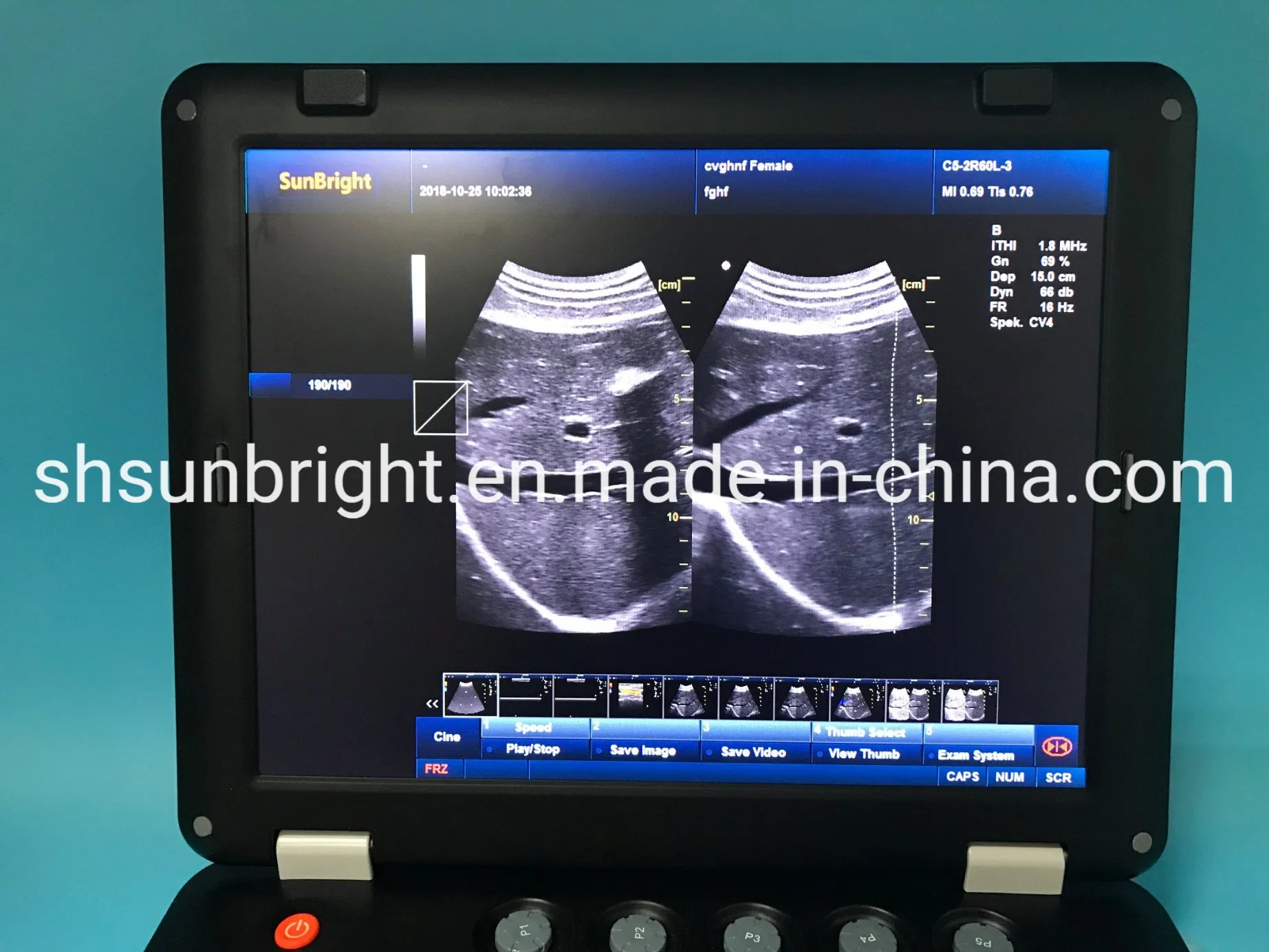 Sun-906A Doppler Ultrasound Laptop 3D 4D Color Doppler Ultrasound