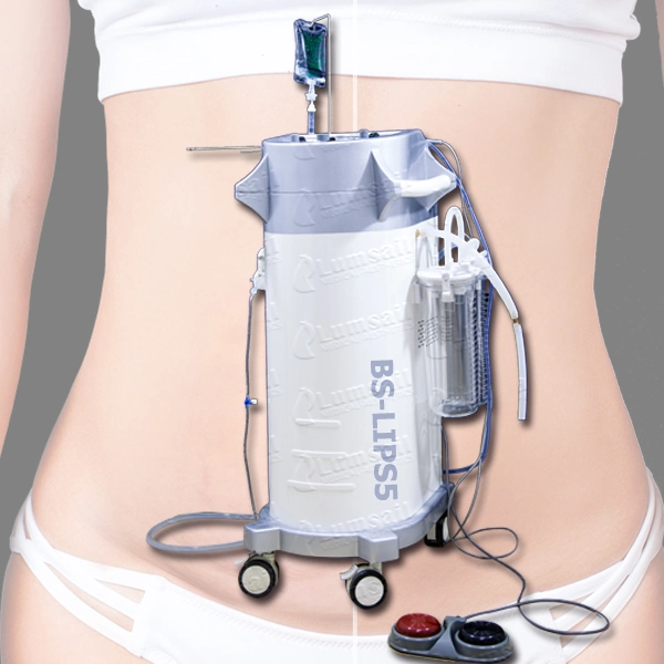 Machine de liposuccion chirurgicale accessoire de résonance de greffe de graisse pour affiner le corps.