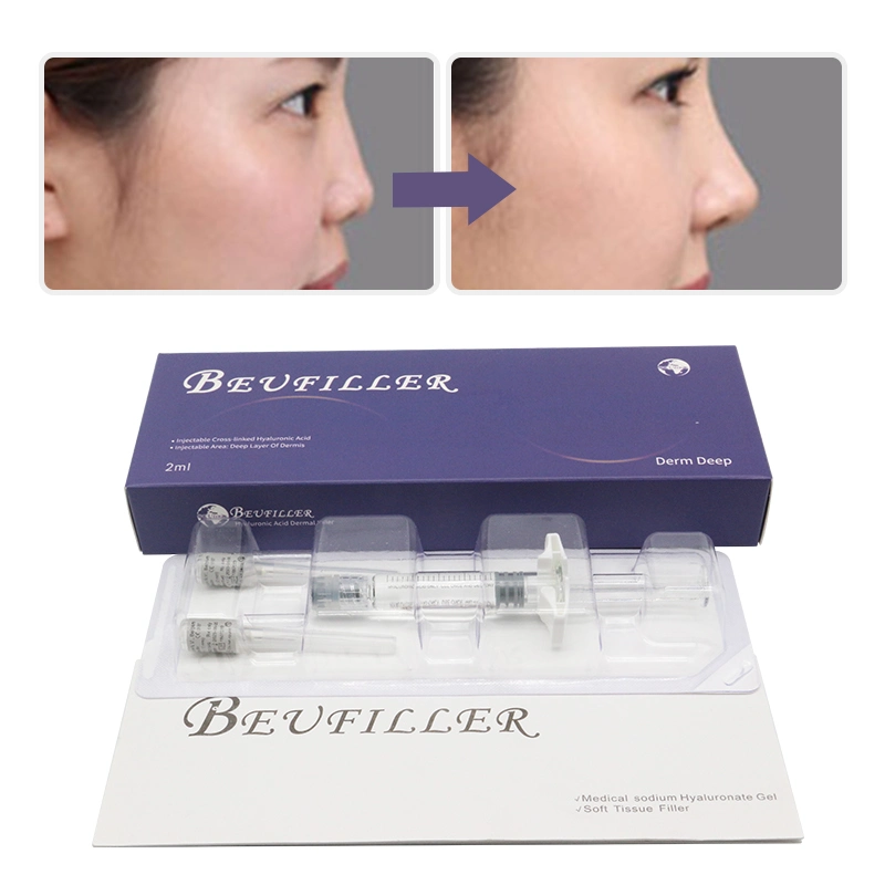 China Best Hot Selling 2ml Deep Derm Face Filler Lip Injection Hyaluronic Acid Dermal Filler