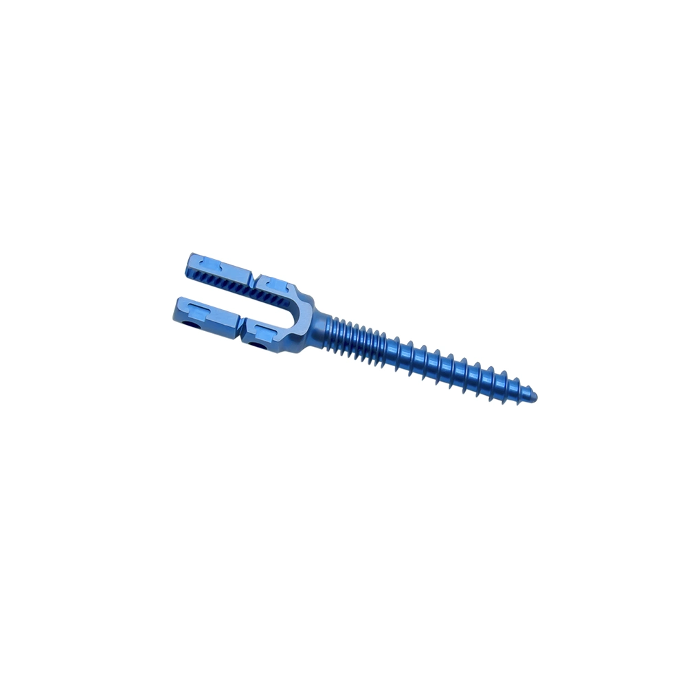 Titanium Spinal Rod Syatem Double Thread Spinal Pedicle Screw