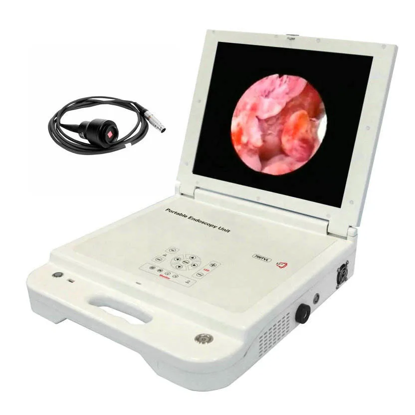 17 pulgadas Gran pantalla HD portátil Ent Endoscope Cámara HD Unidad de Endoscopia portátil