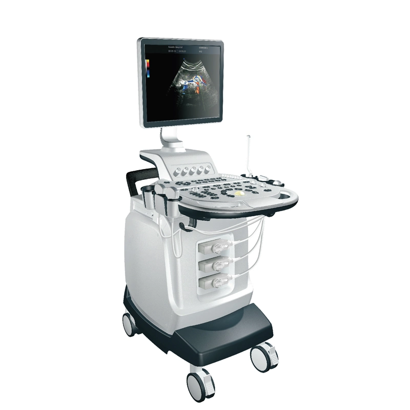 جهاز MY-A028 4D Color Doppler Ultranic Diagnostic System Trolley Ultrasound Scanner الماكينة