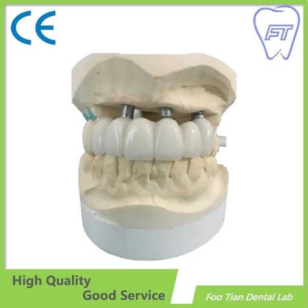 Professional Services Bruxzir Solid Stable Zirconia Bridge From China Dental Lab