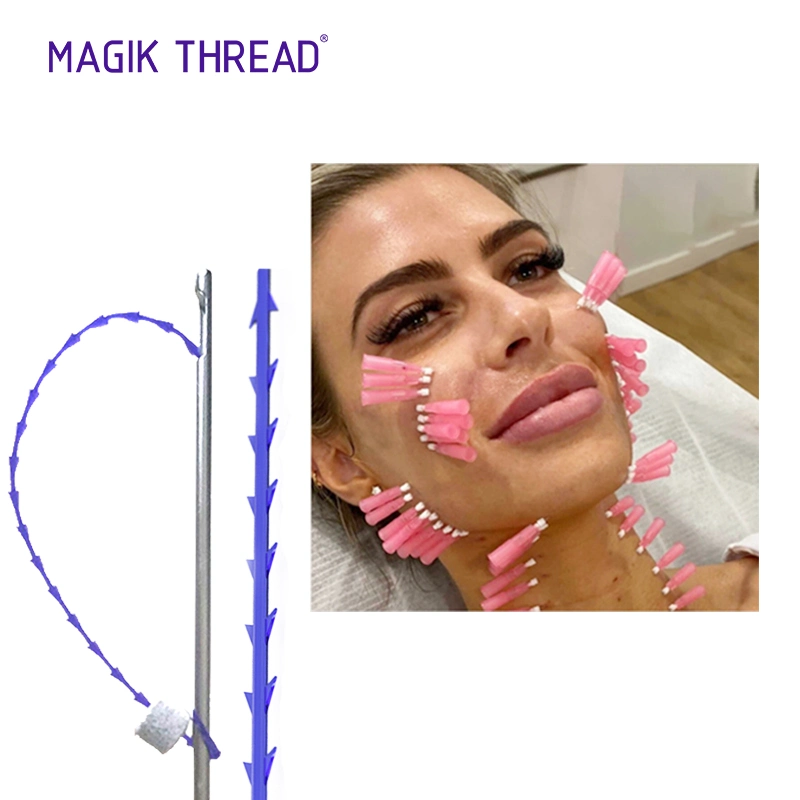 Magik Thread nez yeux corps cosmétiques collagène aop avec filetage Coût de levage