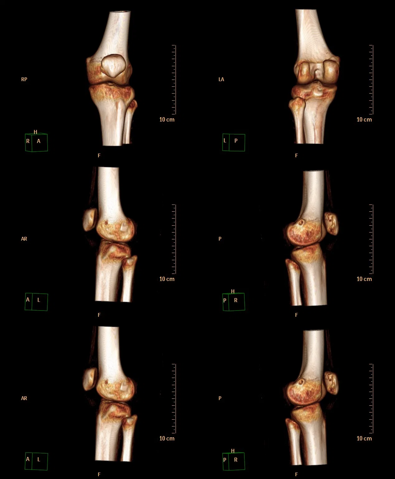 Hospital Use Radio Graphic Medical X-ray Film Imaging