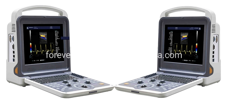 Best Price Portable Color Doppler Ultrasound