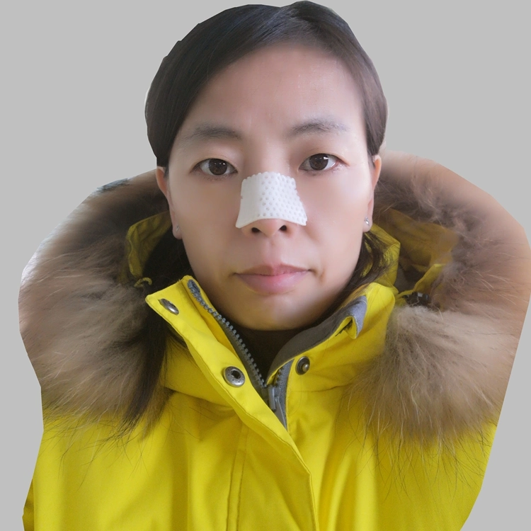 Rhinoplasty or Plastic Surgery Splint Nose Fracture Brace Thermoplastic Nasal Splint Sheets with CE ISO13485