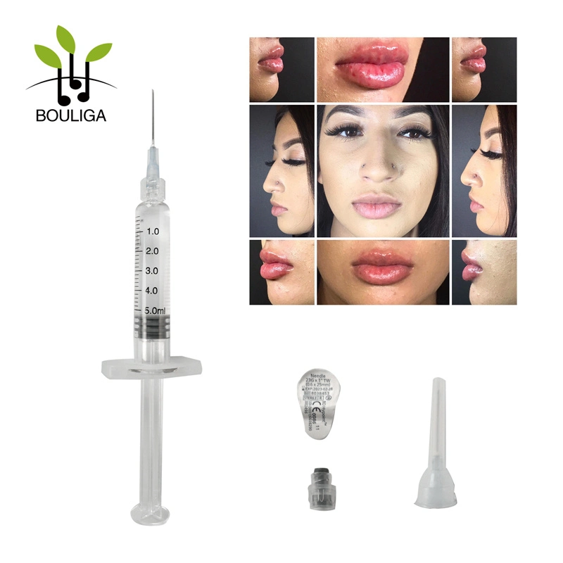 Venta en caliente Bouliga 1ml CE aprobado ácido Hialurónico ligado a la Cruz Cuidado de la piel ácido Hialurónico inyectable para el realce del labio