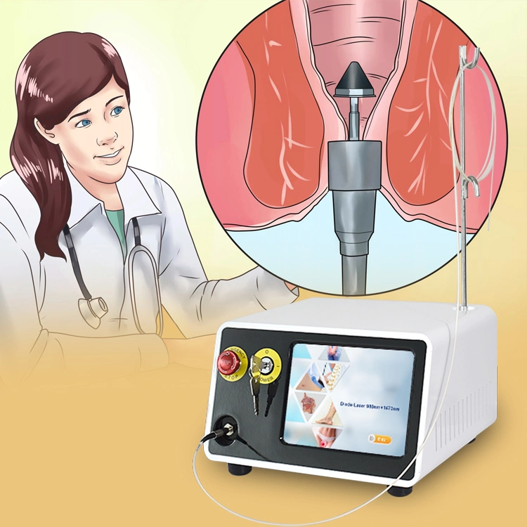 Triangelaser Laseev Proctologie Surgical fistule Anal laser 980 1470 médical Laser