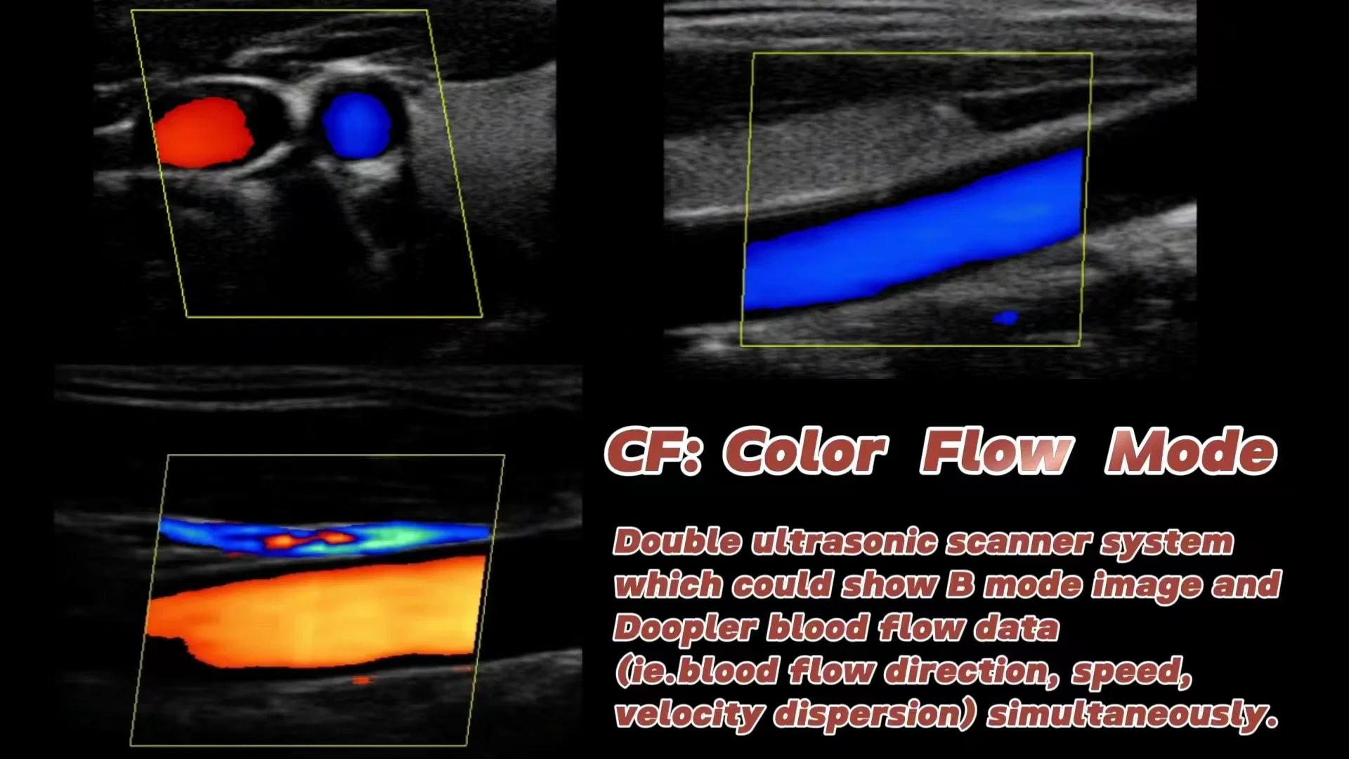 Colour Doppler Ultrasound Scanner of China Manufacturer (K10)