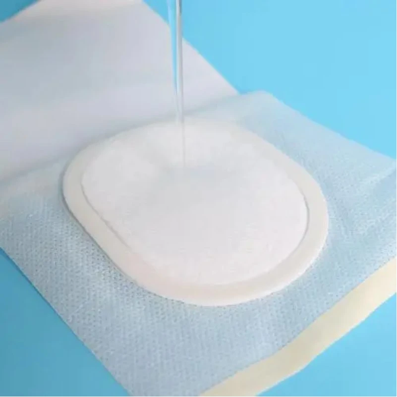 Espuma de PU hidrgel de poliuretano transparente para fins médicos líquido de colagénio impermeável absorvente elevado Penso adesivo em feridas hidrocolóides