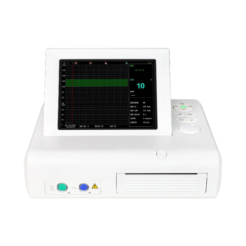 Contec Ce Cms800g Monitor Fetal Ultrasónico de Bebé Ritmo Cardíaco Movimiento del Feto Marca Sensor Toco Máquinas Ctg