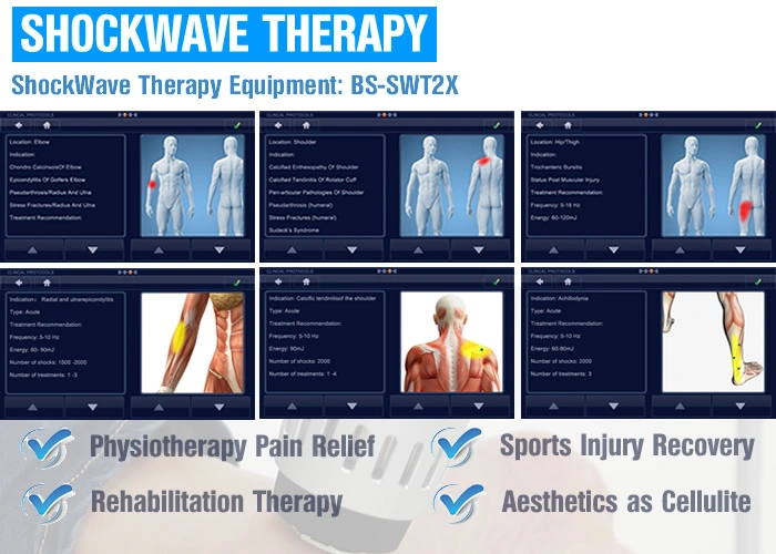 Weihnachtsgeschenk ESWT Shockwave Therapie Ausrüstung für kleine Unternehmen bei Zu Hause