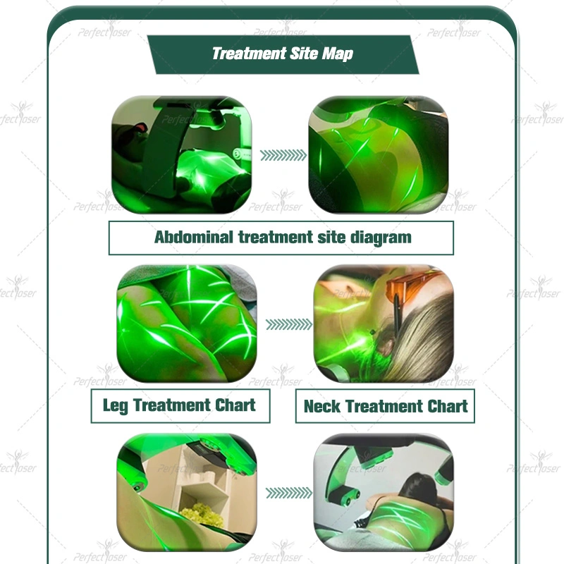 10d Lipo Emerald Green Body Sculping Neck Fat Weight Loss الليزر