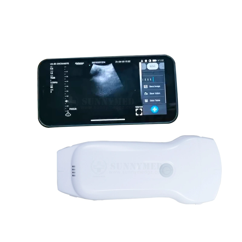 Sy-A053cl Wireless Wi-Fi Ultrasound Mini Handheld Ultrasound Machine for Android Windows System