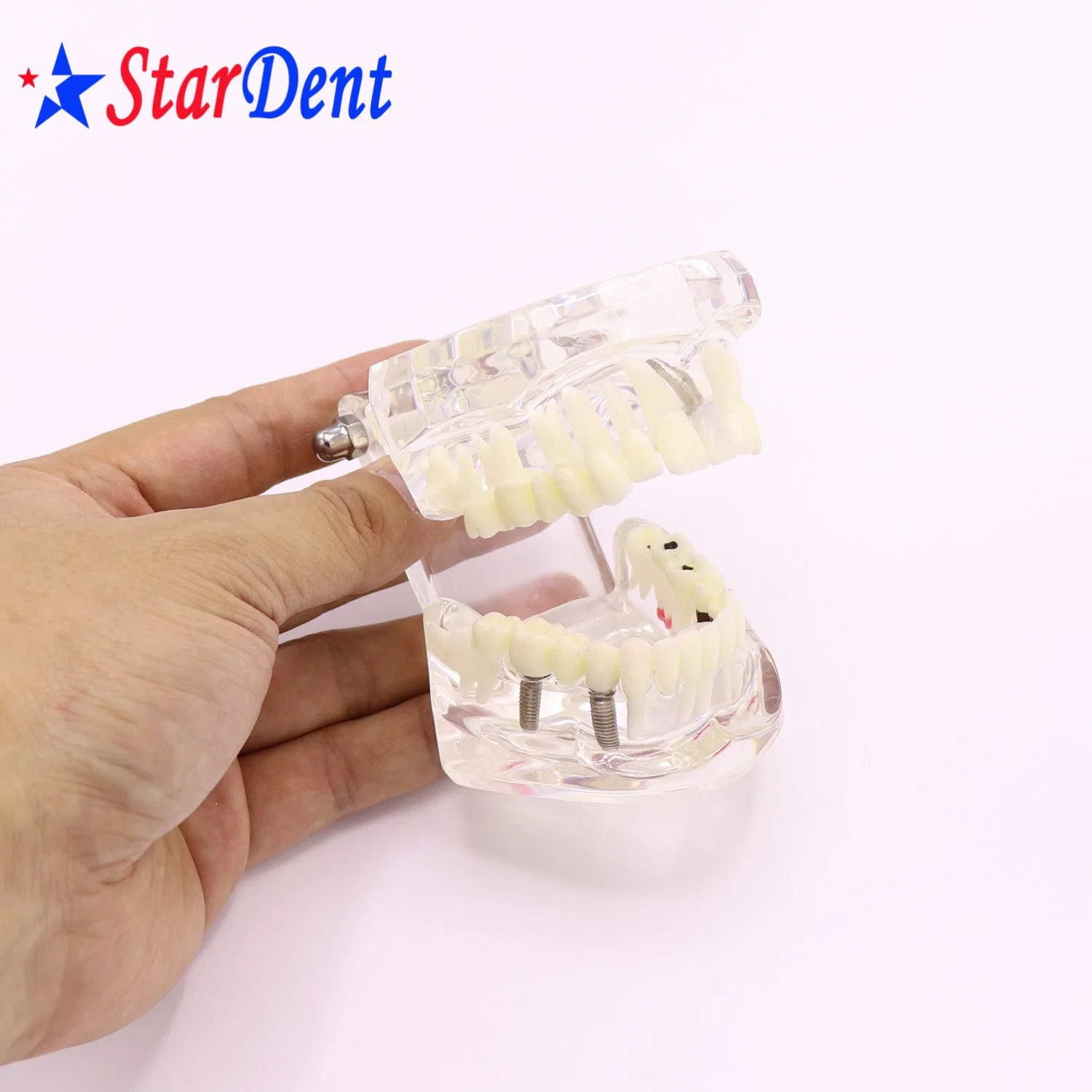 Transparent Adult Pathology Dental Model, Dental Teaching Model Teeth Model