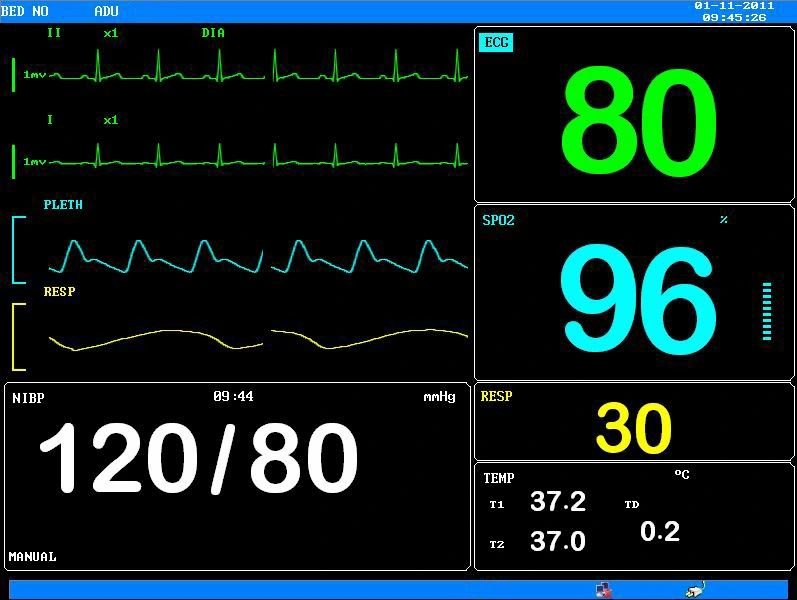 Medical Equipment of Portable Vital Signs Patient Monitor Price (PDJ-3000)