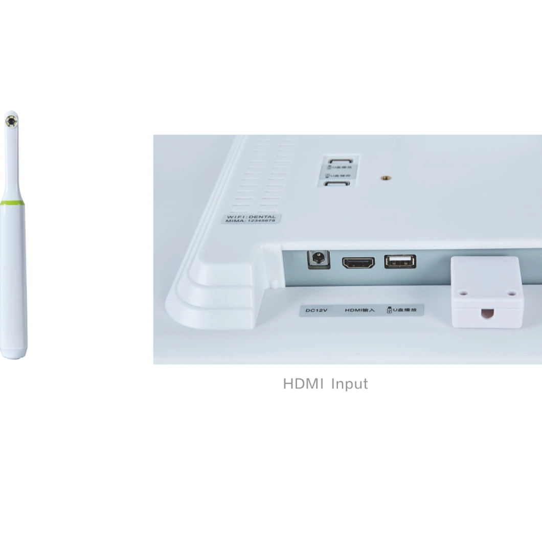 2022 New Hot Sell Uga Model Best Dental Intraoral Camera