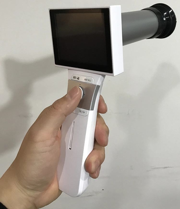 Ophthalmic Equipment Portable Digital Eye Fundus Camera