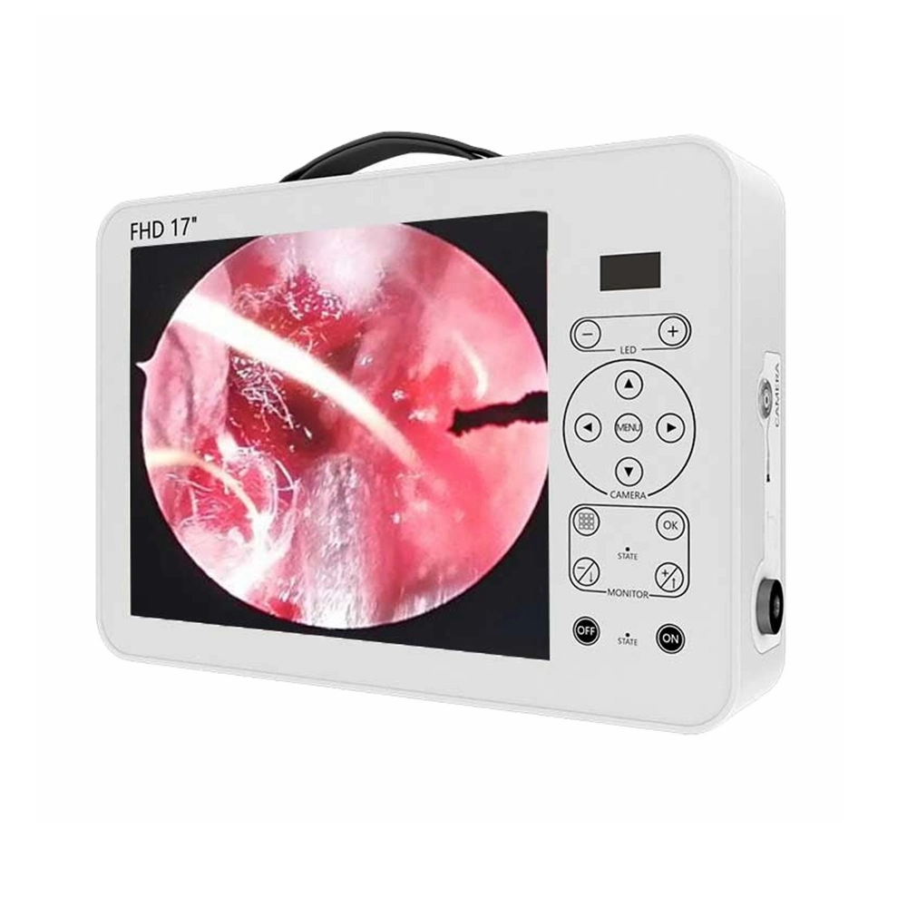 2023 Nuevo Diseño Portable Full HD de la Unidad de Endoscopia Endoscopia Sistema Médico de la cámara laparoscópica