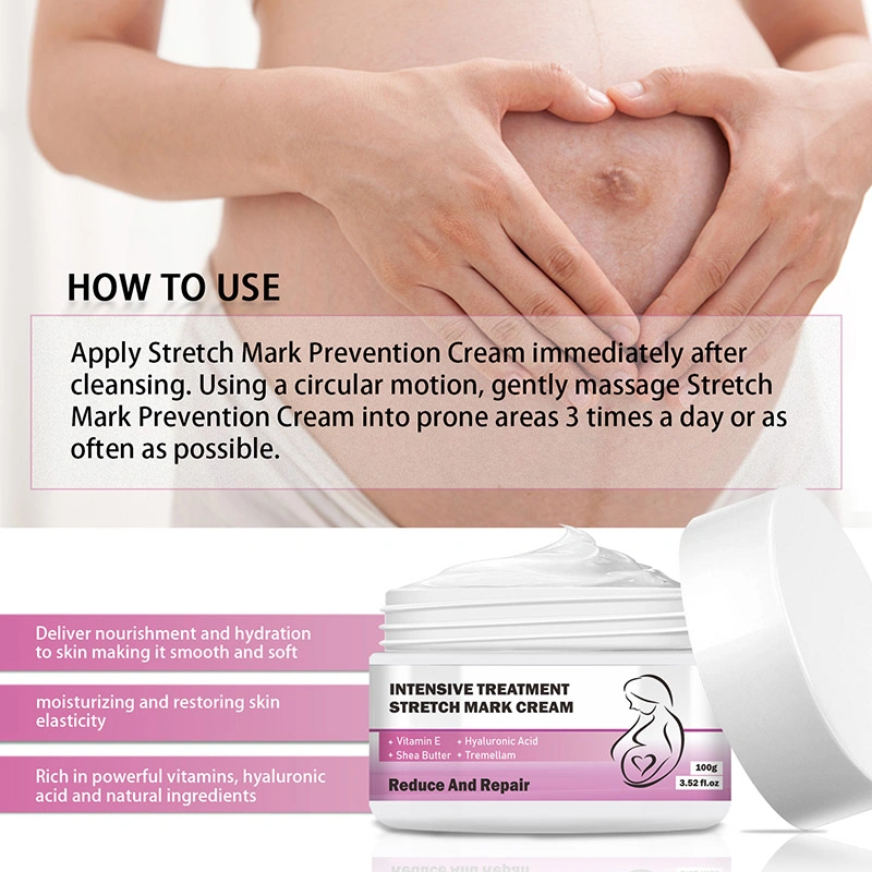 Custom Logo Pregnancy Women Skin Care Body Repair Acne Scar Removal Cream Natural Stretch Marks Cream Private Label