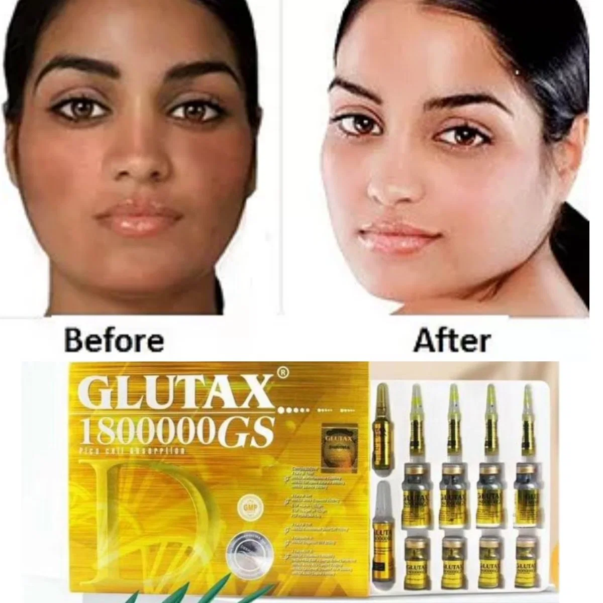 Hot Selling Italy IV Glutathione Glutax 2000GS 1800000GM Skin Whitening Injections for Clear Skin 70000GM 750000gx Lightening