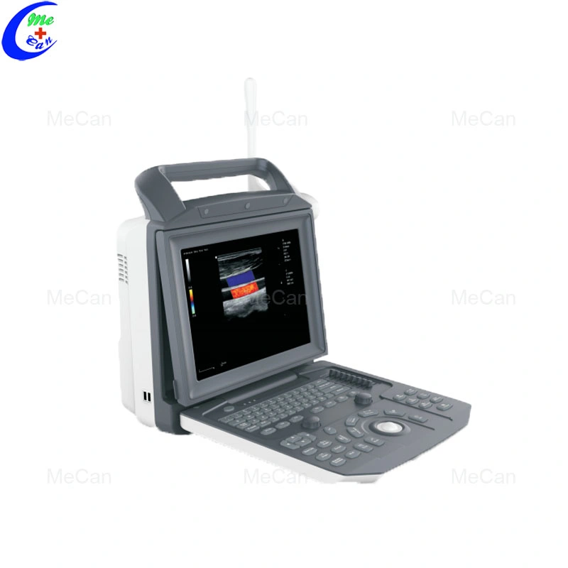 Pregnancy China Convex for Pet Shenzhen Portable 4D Ultrasound Scanner with Good Price