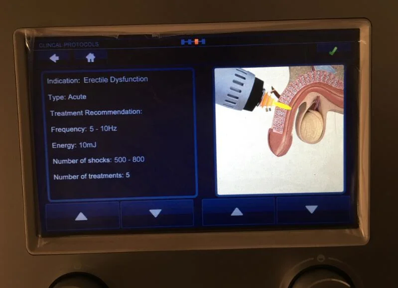 Lineal Lswt la Terapia de Ondas de Choque para la Disfunción Eréctil