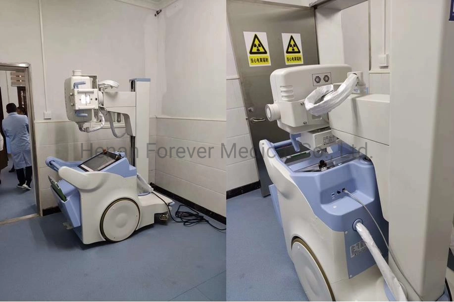 Mobile X-ray Machine Unit Digital