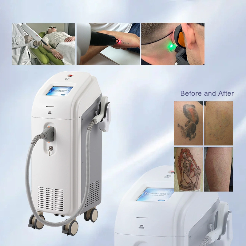 Haute efficacité Qswitched ND YAG à haute efficacité énergétique Le pigment Tattoo Spot dépose de la machine laser
